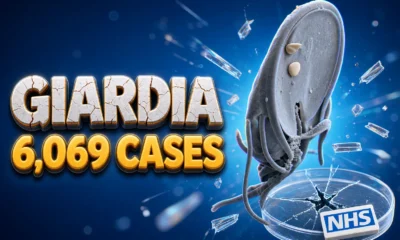 England giardia cases 6069 decade high UKHSA
